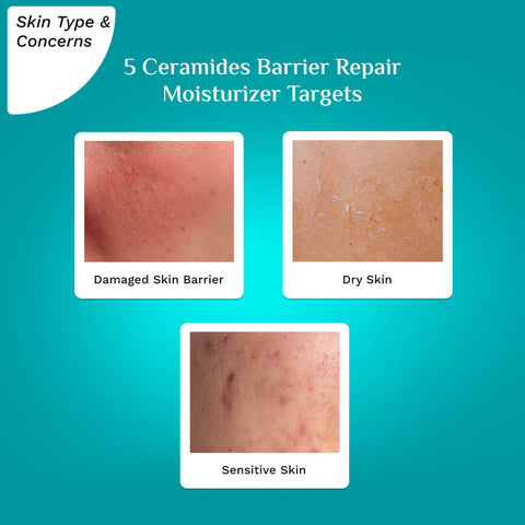 Pilgrim 5 Ceramides Barrier Repair Moisturizer 100g