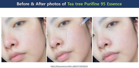 Dr.Ceuracle Tea Tree Purifine Essence, Waterless Formula, 50ml - Image 3