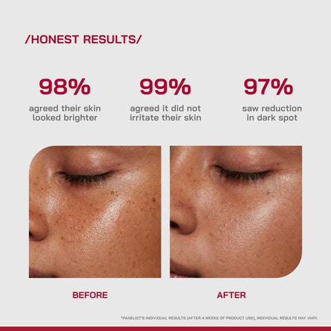 PHD 10% Vitamin C Brightening Face Serum - Antioxidant Blend, 30ml - Image 4