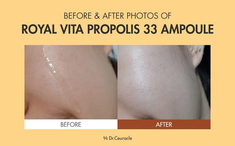 Dr. Ceuracle Royal Vita Propolis 33 Ampoule - Propolis & Vitamin Serum, 15ml - Image 4