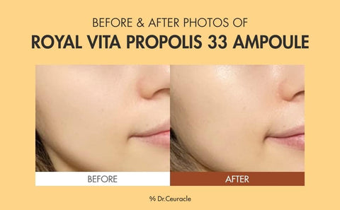Dr.Ceuracle Royal Vita Propolis 33 Ampoule - Face Serum with Propolis Extract, 30ml - Image 4