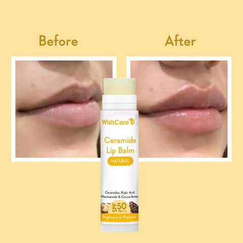 Wishcare Ceramide Lip Balm with SPF50 PA+++ - Kojic Acid & Niacinamide - For Lip Lightening