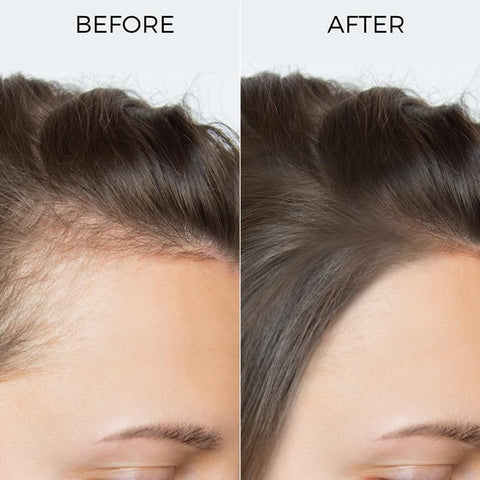 Brillaire Pure Rosemary Essential Oil - 100% Natural Topical Hair Treatment - 15ml - Image 5