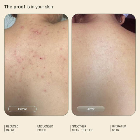 Arata 1% Salicylic Acid Exfoliating Body Wash - 300ml - Image 3
