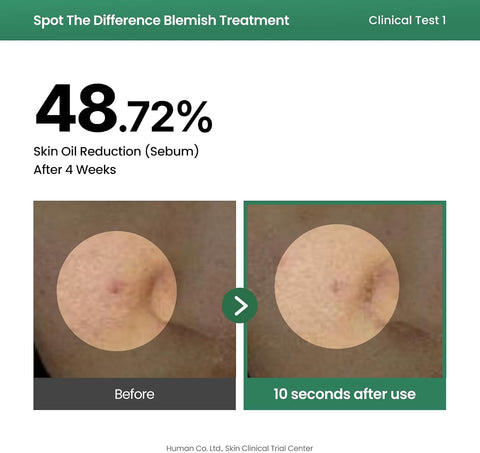 AXIS-Y Spot the Difference Blemish Treatment Serum 15ml - 4-Terpineol & Niacinamide - Image 5