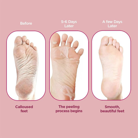 Furr Exfloating Foot Peel Mask
