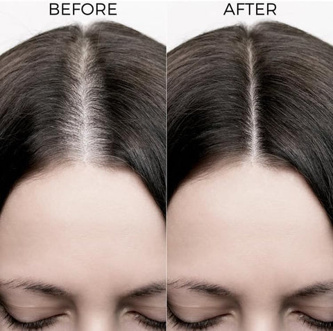 Brillaire Caffeine Shampoo - Hair Fall Control, Sulfate-Free - 200ml - Image 5