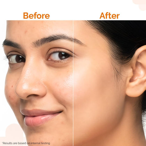 The Derma Co Pore Minimizing Priming Sunscreen SPF 50 with 4% Niacinamide - 50g - Image 8