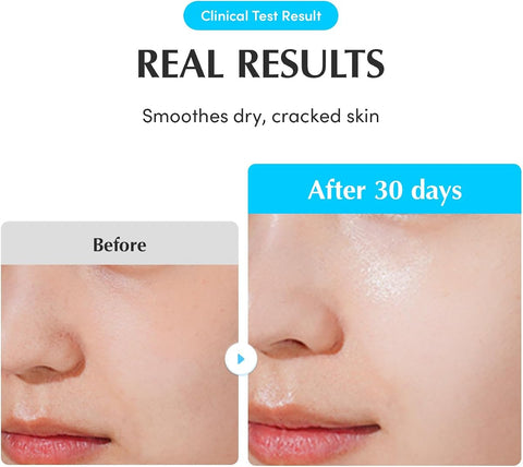 Eqqualberry Hydrating Hyaluronic Acid Face Serum with Cica Extracts - 50ml - Image 6