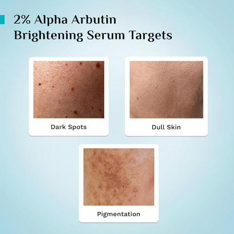 Pilgrim Korean Brightening Face Serum with Alpha Arbutin & Vitamin C - 30ml - Image 5