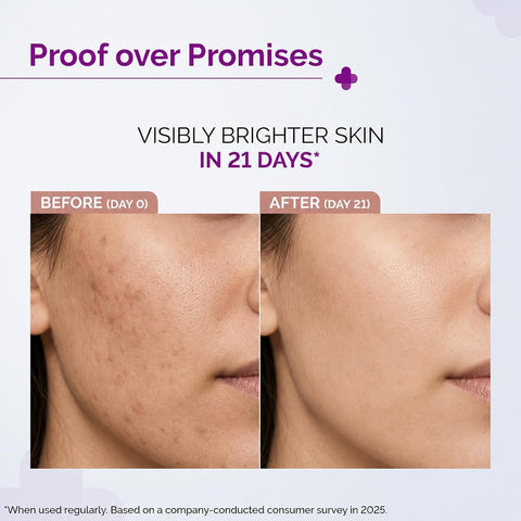 The Derma Co Face Serum - 10% Vitamin C with Niacinamide & Hyaluronic Acid, 30ml - Image 3