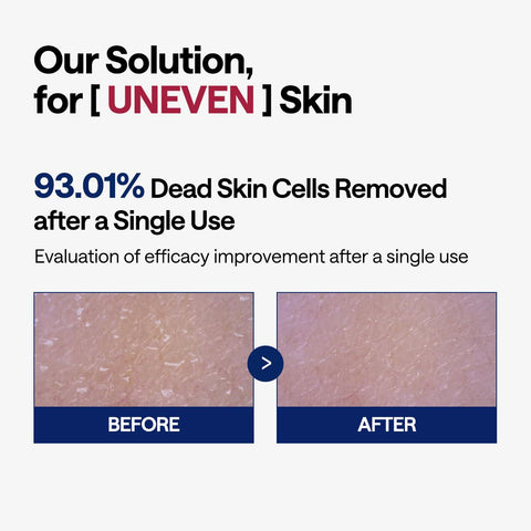 Mediheal Phyto - Enzyme Peeling Pad 90's