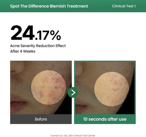 AXIS-Y Spot the Difference Blemish Treatment Serum 15ml - 4-Terpineol & Niacinamide - Image 6
