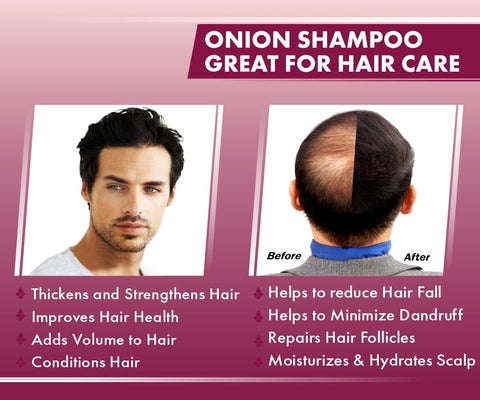 Urban Gabru Natural Onion Shampoo - Paraben & Sulphate Free, 200g - Image 6