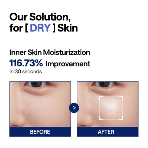Mediheal Watermide Moisture Pad 100's