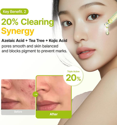 Purito Seoul Azelaic Acid 10% + Kojic + Tea Tree Serum - 30ml - Image 6