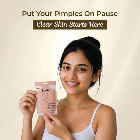 Sanfe Promise Face Acne Pimple Patch - Hydrocolloid Treatment, 36 Patches - Image 5