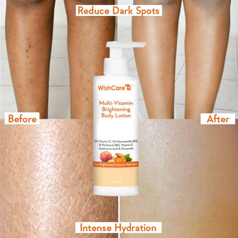 WishCare Multi-Vitamin Brightening Body Lotion - 5% Vitamin C & Niacinamide, 200ml - Image 4
