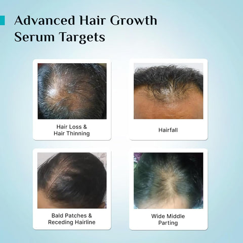 Pilgrim Hair Growth Serum with Redensyl, Anagain & Capilia - 30ml - Image 6