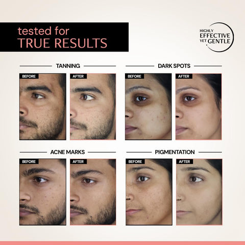 Deconstruct Clearing Serum - 5% Niacinamide & 2% Alpha Arbutin - 20ml - Image 4