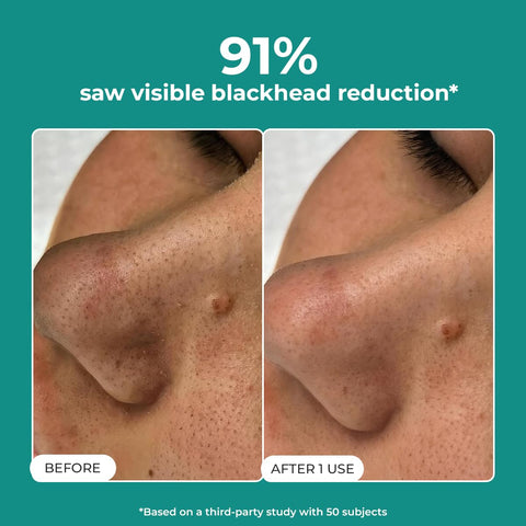 Conscious Chemist Blackhead melting water - 130 ml