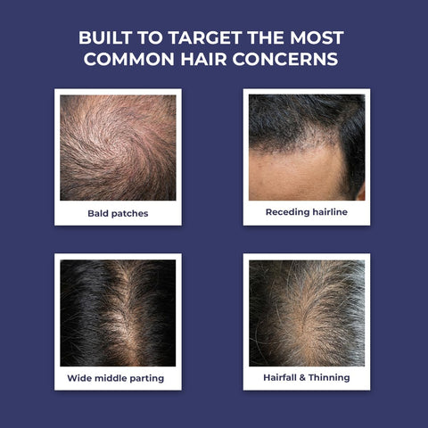 Conscious Chemist Full Strength Anti - Hairfall Shampoo - 200 ml