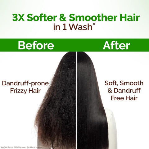 Mamaearth Lemon Anti-Dandruff Conditioner with Lemon & Ginger - 250ml - Image 7