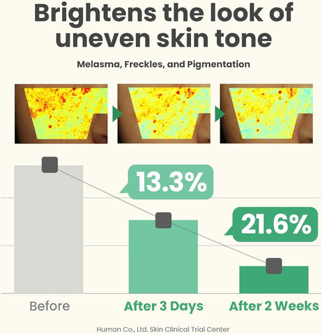 AXIS-Y Glow Your Own Way Limited Edition Skincare Set with Vitamin C & Collagen, 4-piece - Image 8
