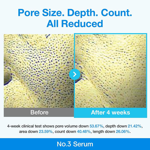 Numbuzin Blue Bio-Retinol Pore Refining Serum - Pore Tightening & Anti-Aging, 30ml - Image 3