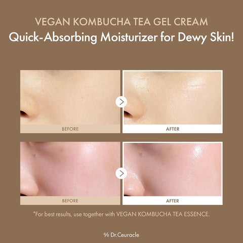 Dr.Ceuracle Vegan Kombucha Tea Gel Cream - Vegan Tea Complex Moisturiser, 75g - Image 2