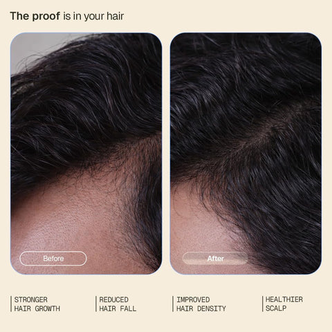 Arata Intensive Hair Growth Serum - 3% Redensyl, 3% Procapil, 5% Capixyl - 30ml - Image 3