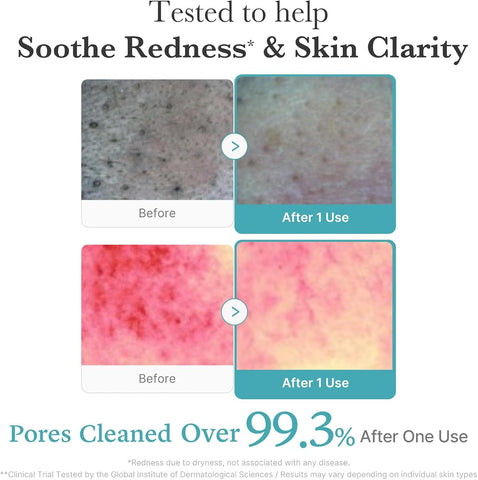 Medicube Facial Cleanser with Azelaic Acid & Niacinamide - Deep Clean Foam, 120g - Image 4