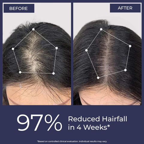 Conscious Chemist Full Strength Anti - Hairfall Post Wash Rosmeary Spray 200 ml