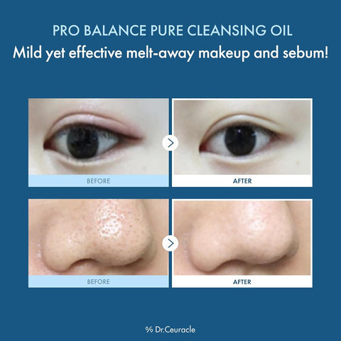 Dr.Ceuracle Pro Balance Pure Cleansing Oil - 155ml, 6 Probiotics - Image 2
