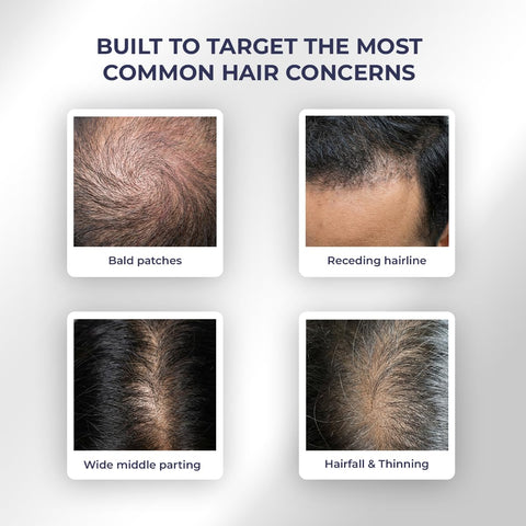 Conscious Chemist Full Strength Pre Wash Rosemary Hair Growth Oil 100 ml