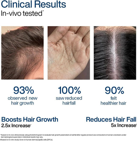 WishCare Hair Growth Serum Concentrate - Redensyl & Anagain, 30ml - Image 3
