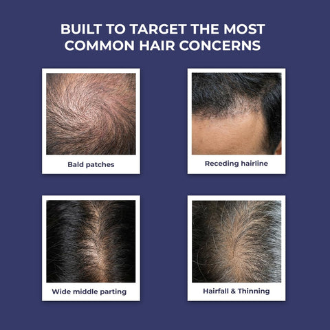 Conscious Chemist Full Strength Anti - Hairfall Post Wash Rosmeary Spray 200 ml