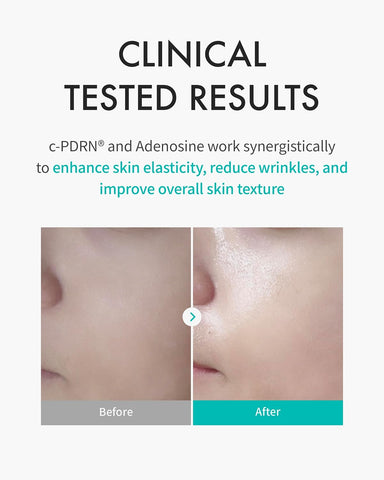 Rejuran Turnover Mask 40Mlx5