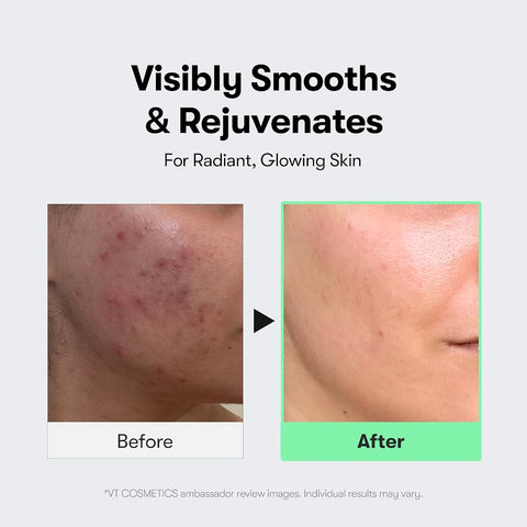 VT Cosmetics CICA Reedle Shot 300 Serum - Microneedling, Centella Asiatica, 50ml - Image 5