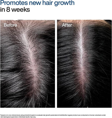 WishCare Hair Growth Serum Concentrate - Redensyl & Anagain, 30ml - Image 6