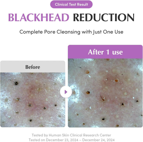 Eqqualberry Purple Rice Double Cleanse Combo