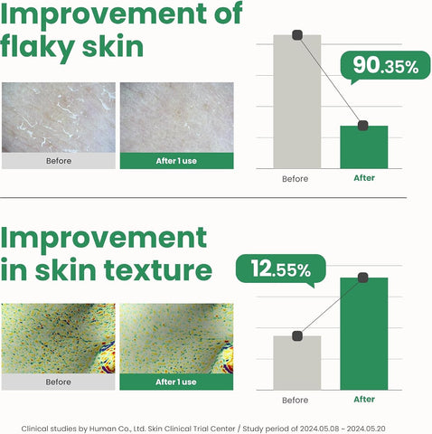 AXIS-Y PHA Resurfacing Glow Peel - Gel Water Peel with 10% PHA, 50ml - Image 5