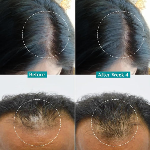 Pilgrim Hair Growth Serum with Redensyl, Anagain & Capilia - 30ml - Image 4