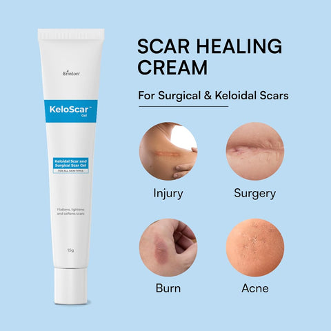 Brinton Keloscar Gel - Surgical Scar Treatment, 15g - Image 2
