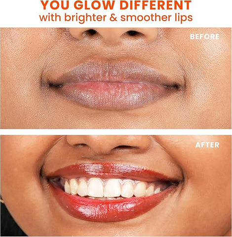 Foxtale Brightening Lip Balm With Peptides, Vitamin C & Hyaluronic Acid Ruby Glaze