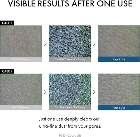 Dr.Ceuracle Pro Balance Night Enzyme Charcoal Wash - 50g - Image 2