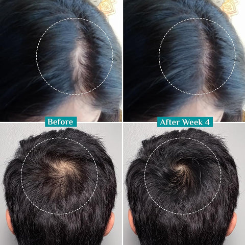 Pilgrim Hair Growth Serum Roll-On with Redensyl, Anagain, Capilia - 25ml - Image 7