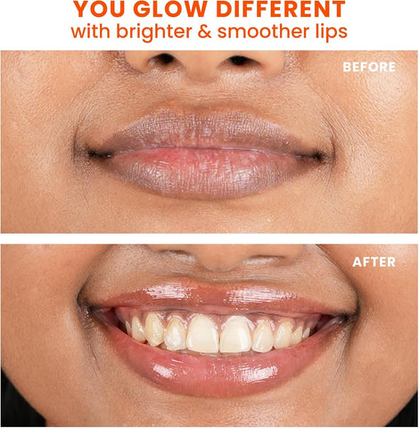 Foxtale SPF 30 Brightening Lip Balm with Peptides & Vitamin C - 12g - Image 5