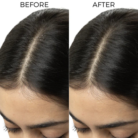 Brillaire Tea Tree Oil 100 Ml