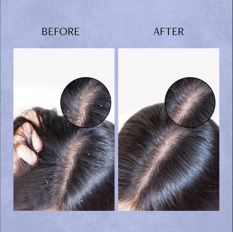 Deconstruct Anti-Dandruff Scalp Serum 100 ml